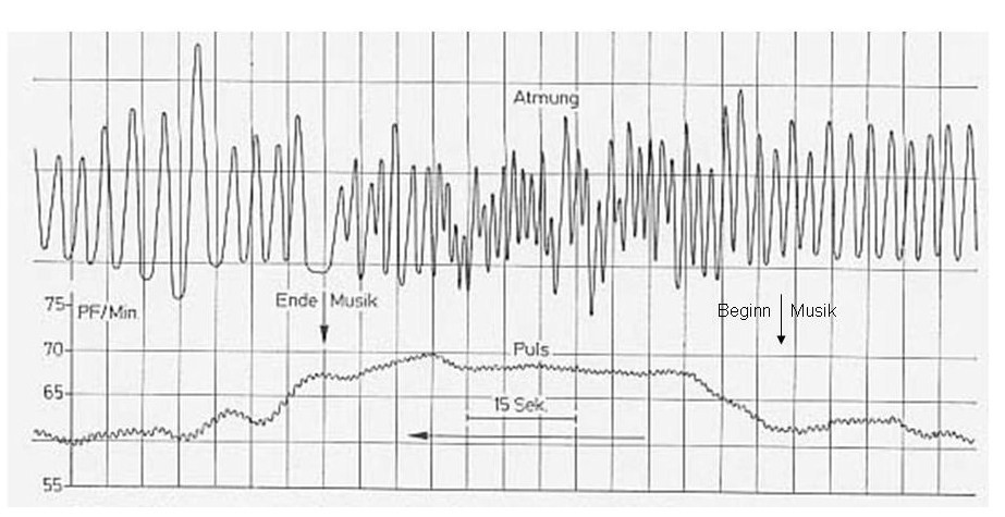 beispielhafte polygraphische Ableitung von Atmung und Pulsfrequenz unter Musikeinfluss